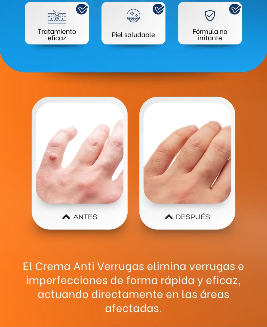 Crema removedora de verrugas⭐