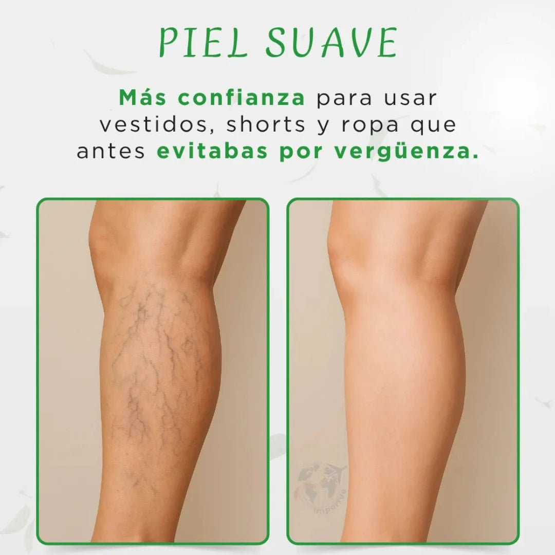 Crema elimina y previene varices a base de Té Verde🌿