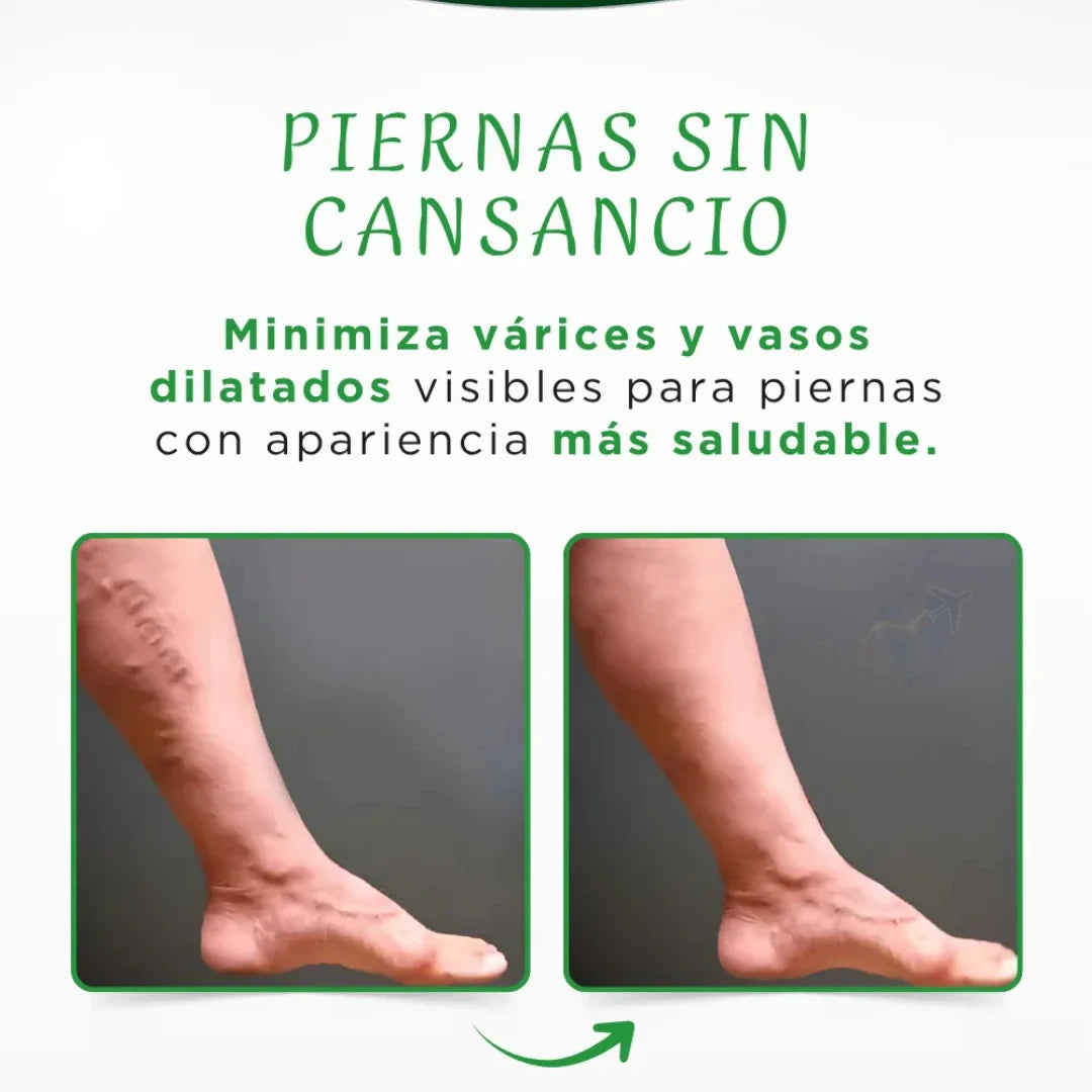 Crema elimina y previene varices a base de Té Verde🌿